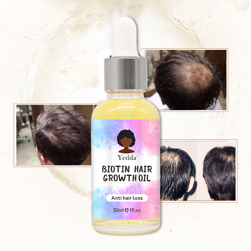 Biotin hair oil to strengthen weak hair roots