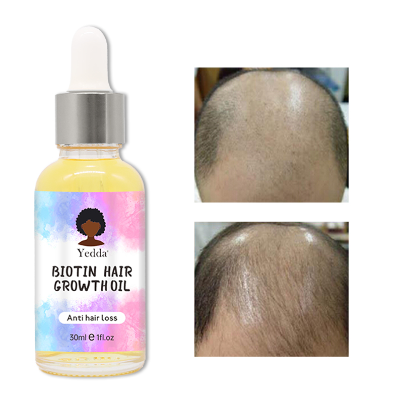 Anti hair loss biotin oil for thicker fuller hair