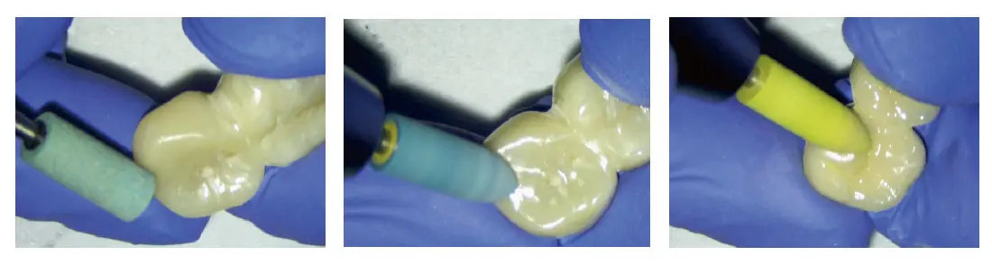 Zirconia Polishing Kit