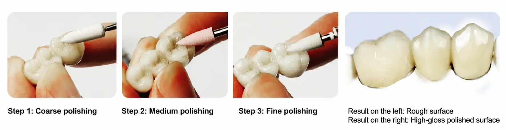 HP0209D Porcelain Extraoral Polishing Kit-3-5.webp
