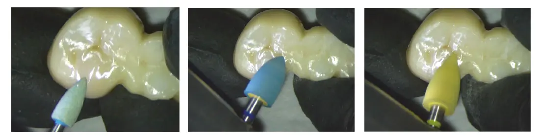dental ceramic polishing kit