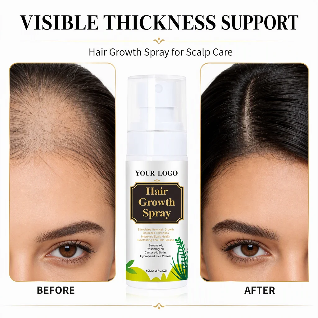 Batana & Rosemary Scalp Spray